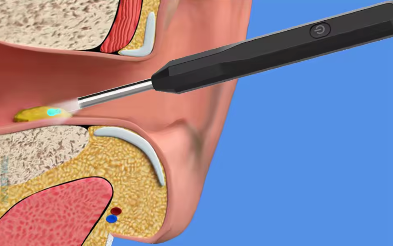 Cuchara Visual para los oídos con camara, endoscopio de limpieza inalámbrico portátil, herramienta para limpiar cera de los oídos de alta definición