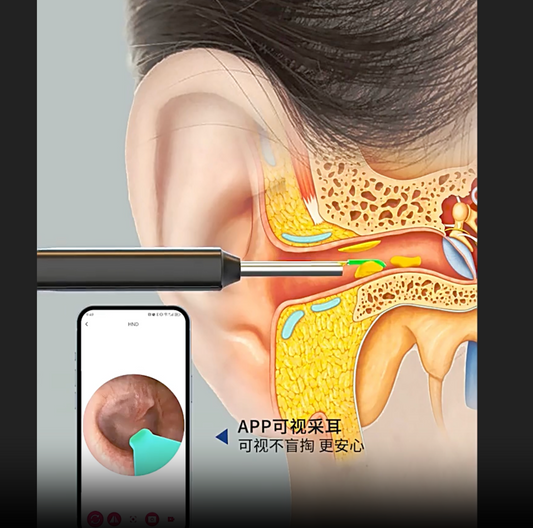 Cuchara Visual para los oídos con camara, endoscopio de limpieza inalámbrico portátil, herramienta para limpiar cera de los oídos de alta definición
